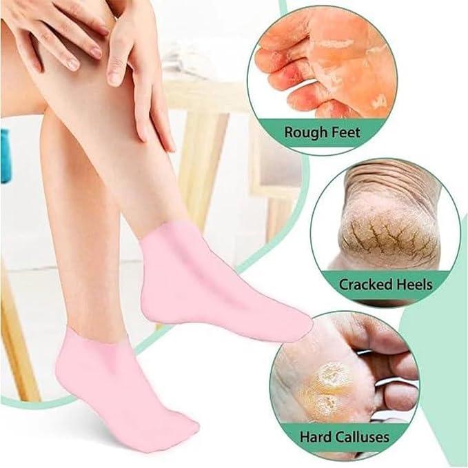 Therapeutic Silicone Heel Socks - Medical Grade Foot Care for Cracked Heel Relief